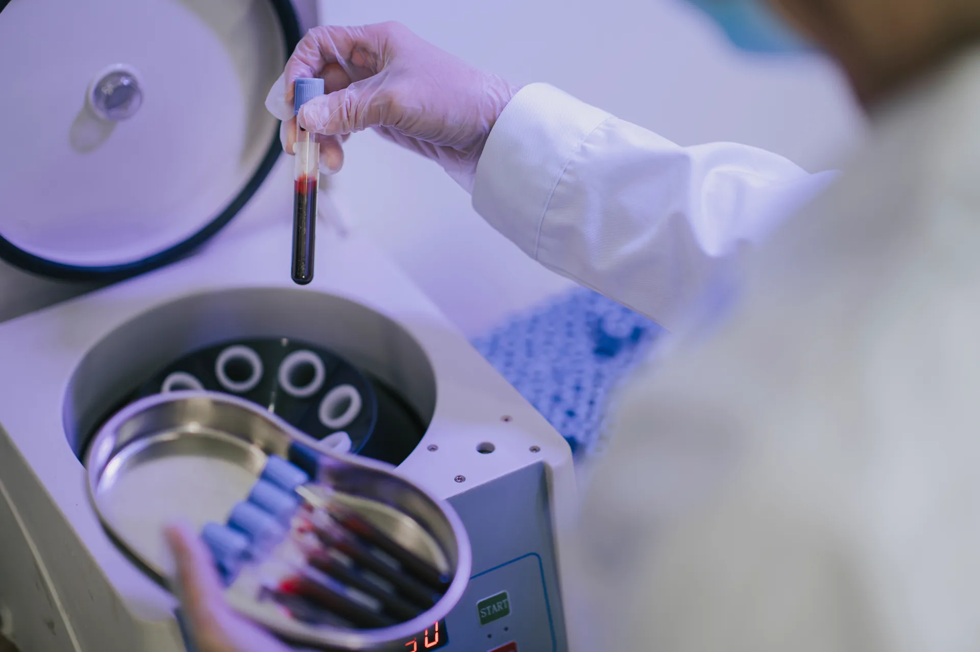 PRP Therapy