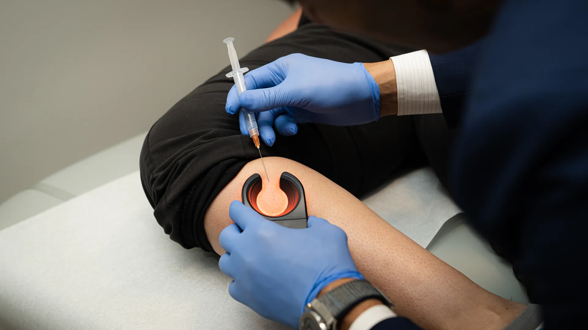 Vein Treatments